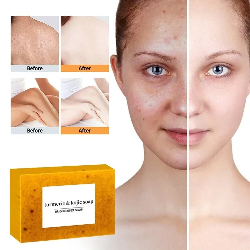 Turmeric Kojic Acid Soap