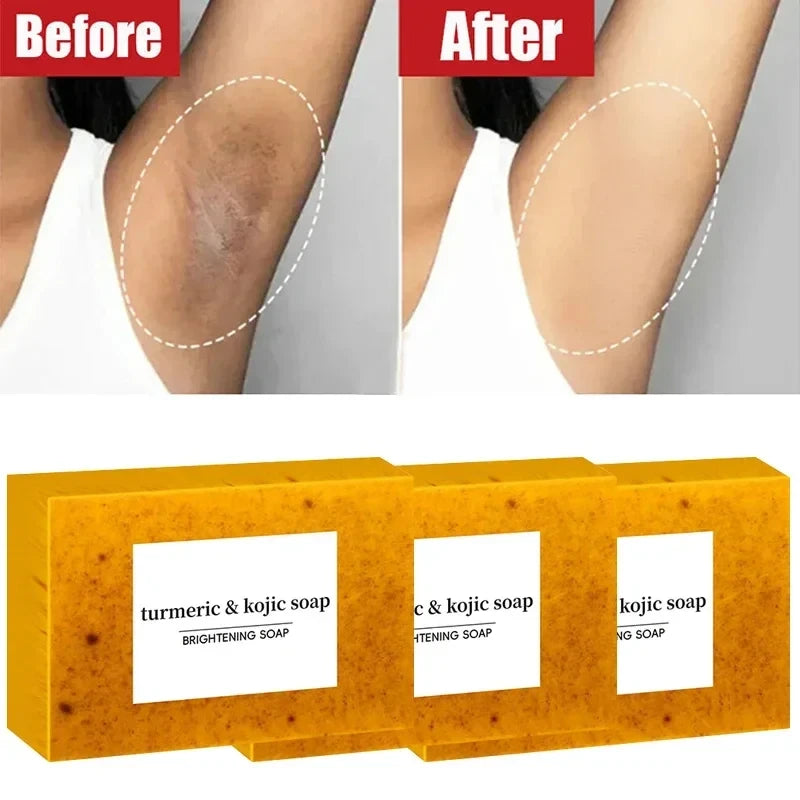 Turmeric Kojic Acid Soap